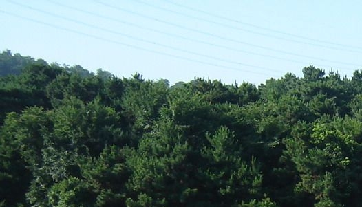 心脏支架植入成功案例